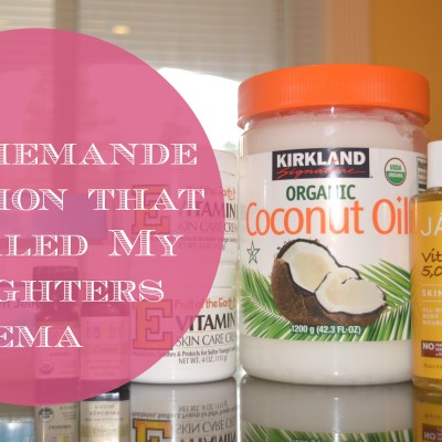 The Homemade Lotion that Healed my Daughters Eczema